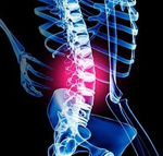 osteoch3