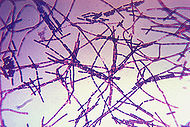 Bacillus