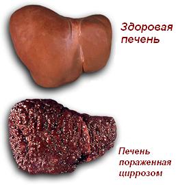 ciroz1