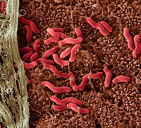 helicobacter-pylori-01-m