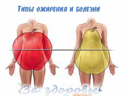 tipy-ojireniya