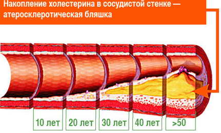 xolesterin