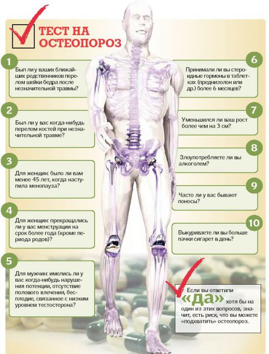 osteoporoz-test