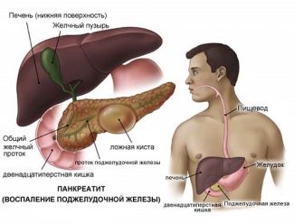 pankreatit