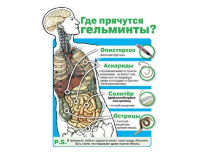 parazitoz_plakat_2